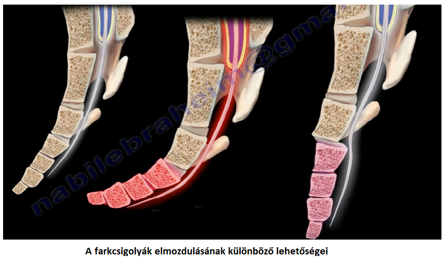 farokcsonti ízületi fájdalom a jobb bokaízület deformáló artrózisa